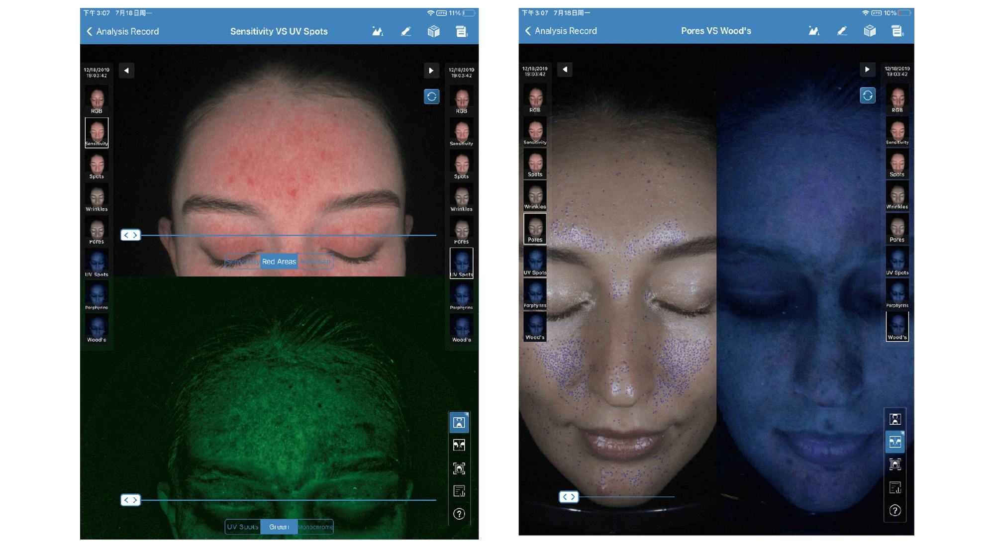 An image of MEICET MC88 skin analysis system output