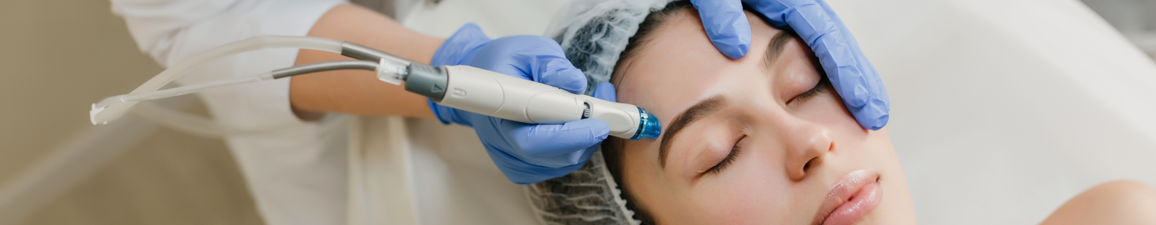 Microneedling treatment banner image