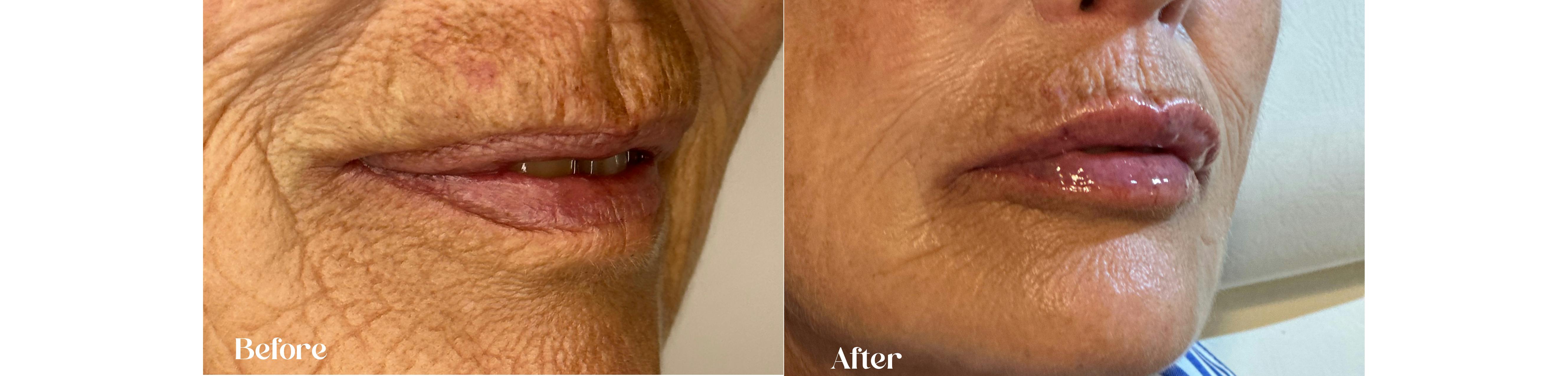 House of Glo Lines and wrinkles natural results