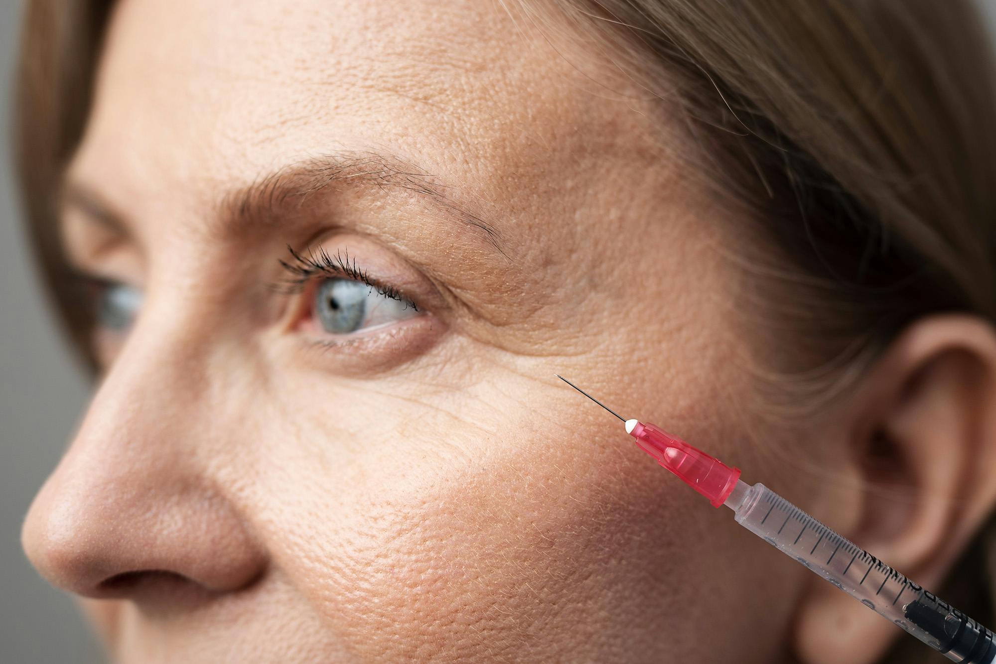 Woman having a crows feet injection
