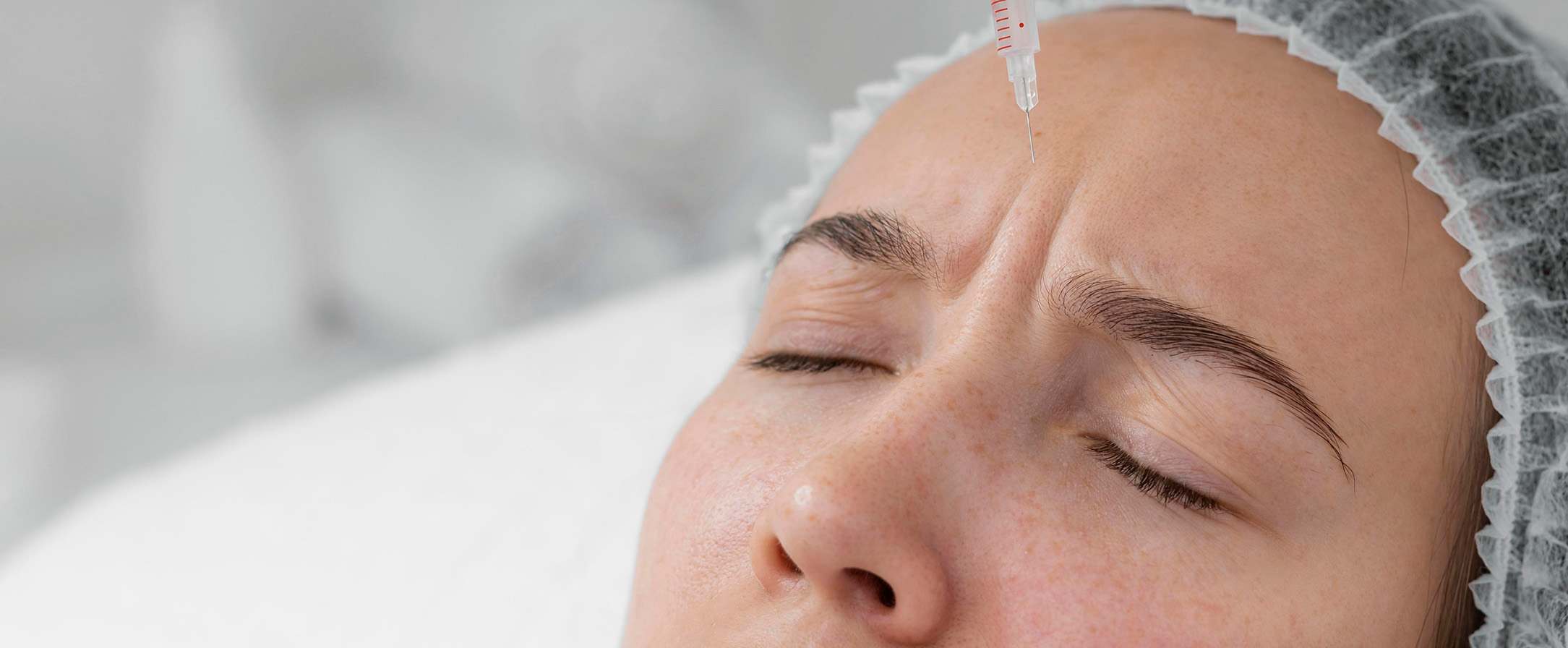 woman receiving frown lines treatment