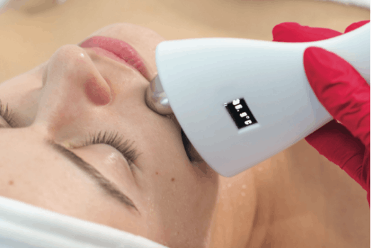 sectum radiofrequency