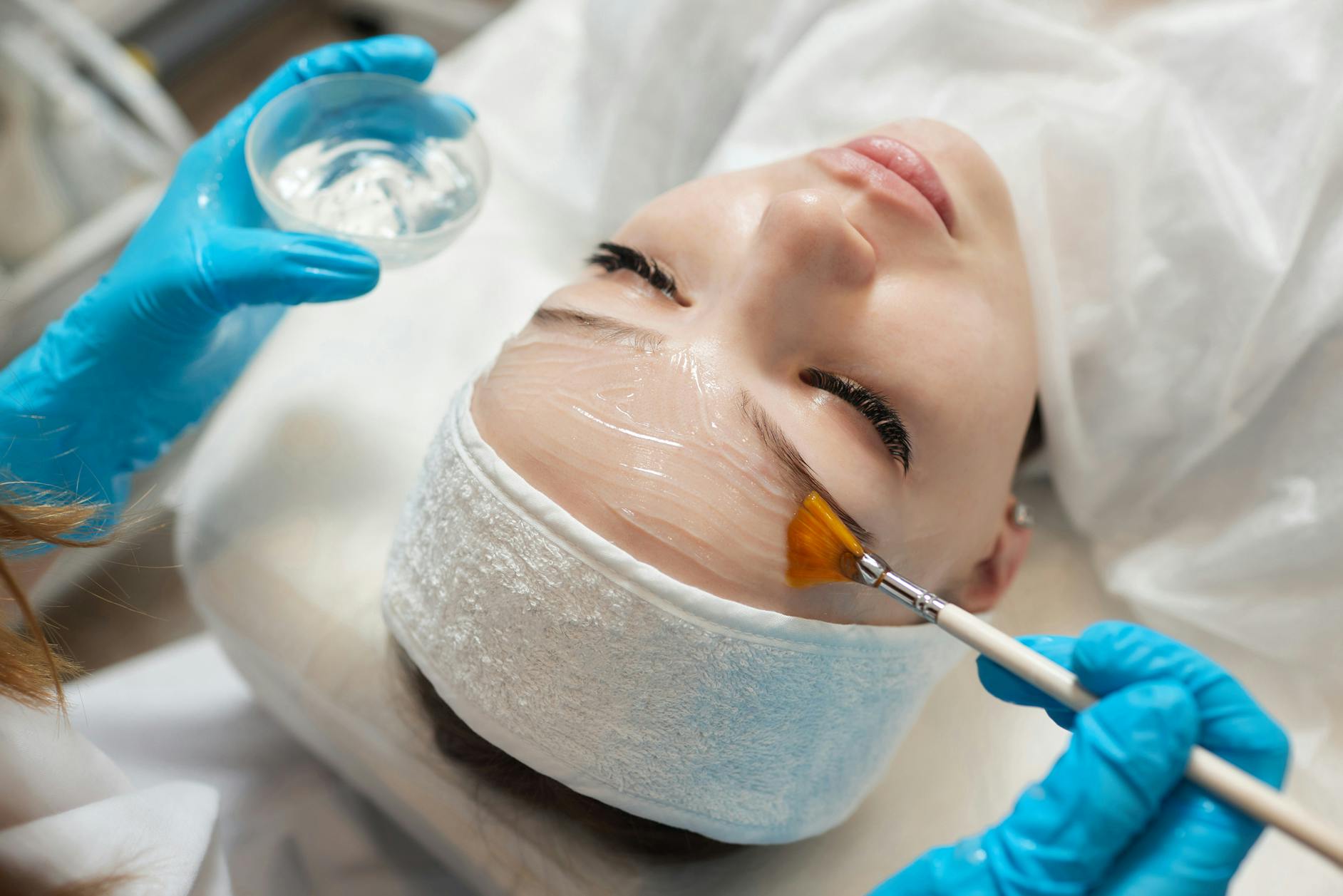 chemical peel treatment being performed