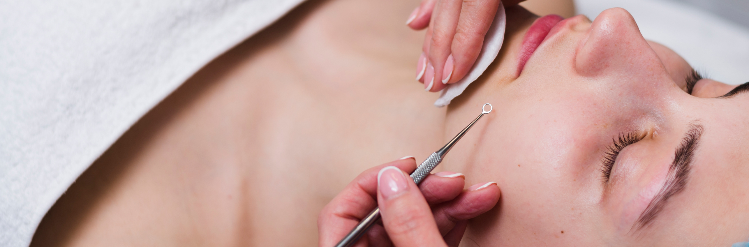 woman having her milia removed by a practitioner