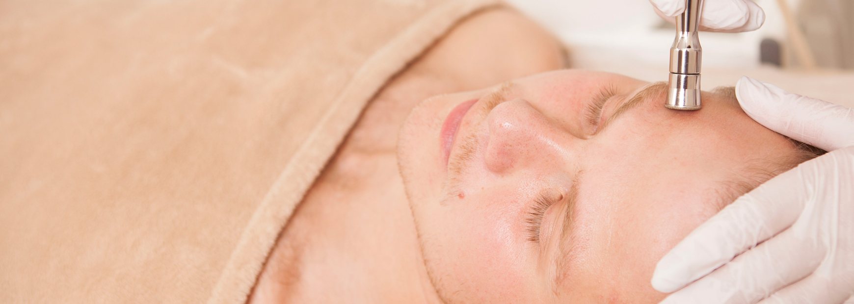 man having microneedling with exosomes treatment