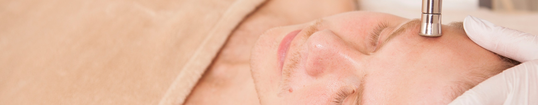 man having microneedling with exosomes treatment