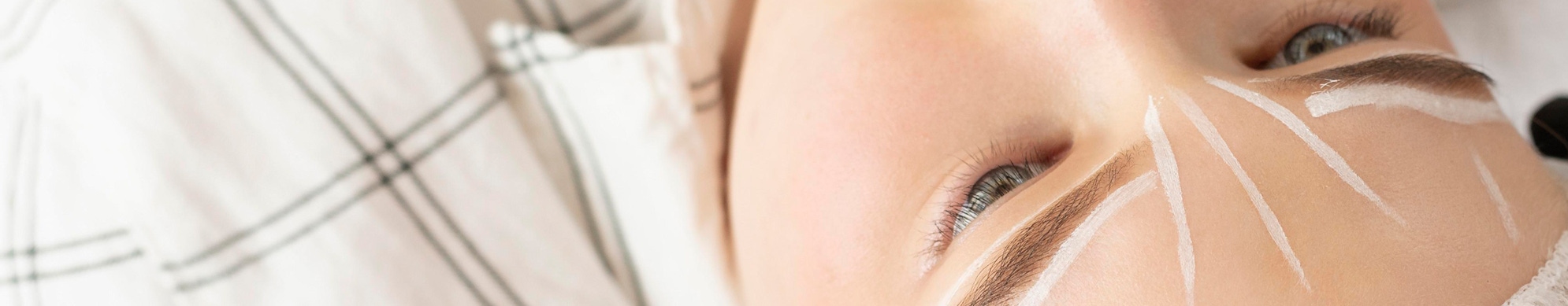 woman getting brow lift treatment