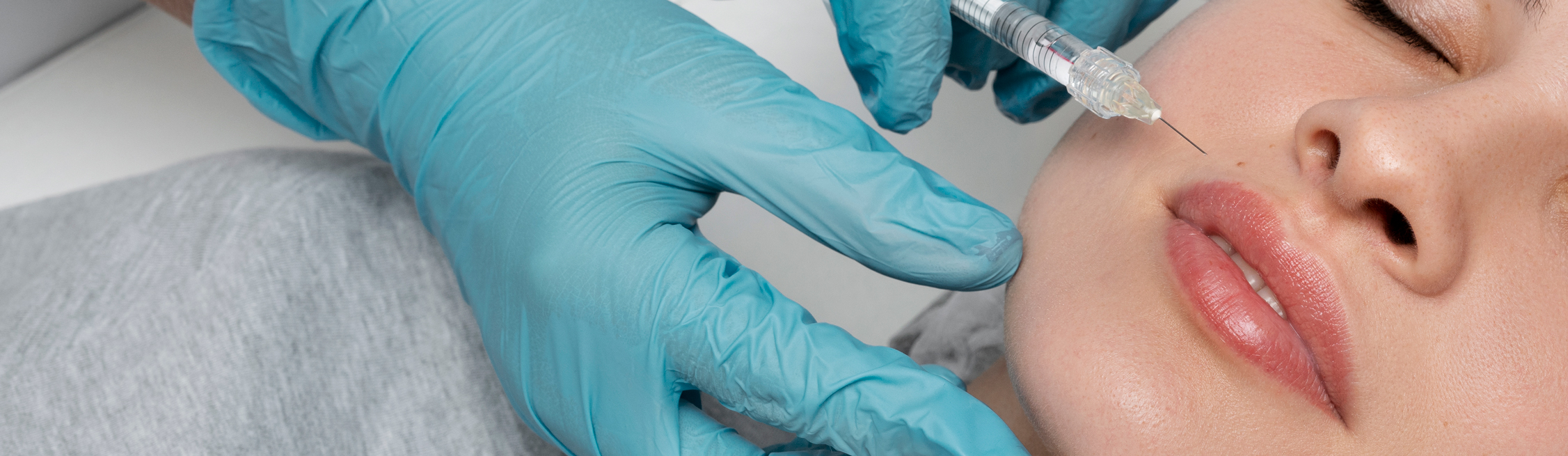 nose to lip lines treatment