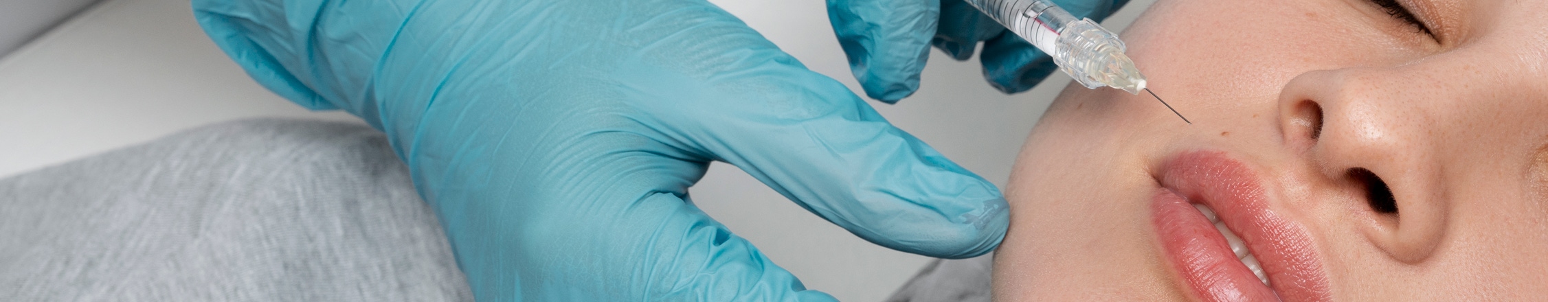 nose to lip lines treatment