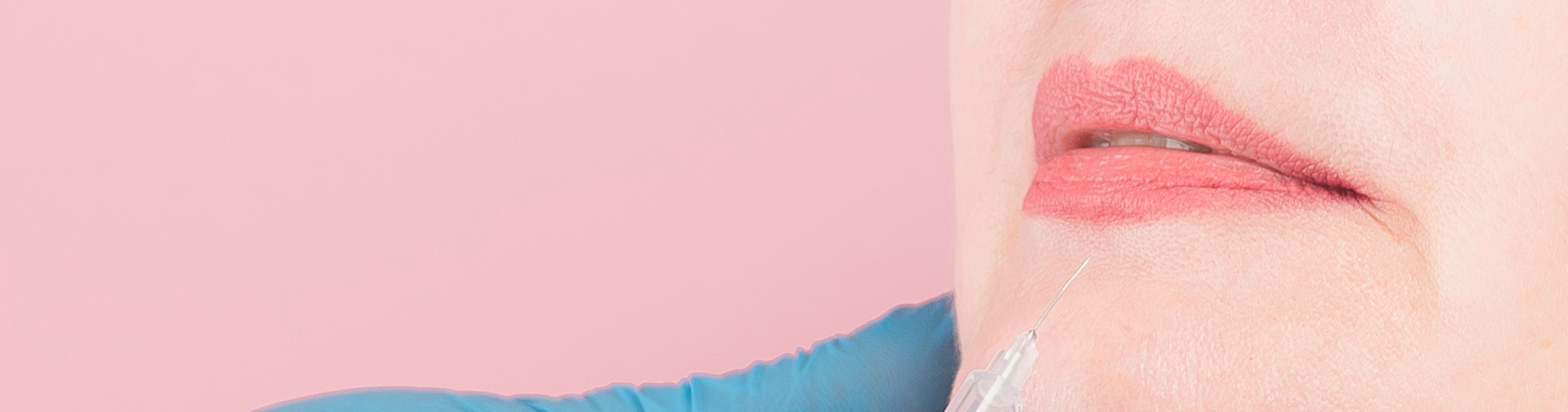 lip to chin lines treatment being performed