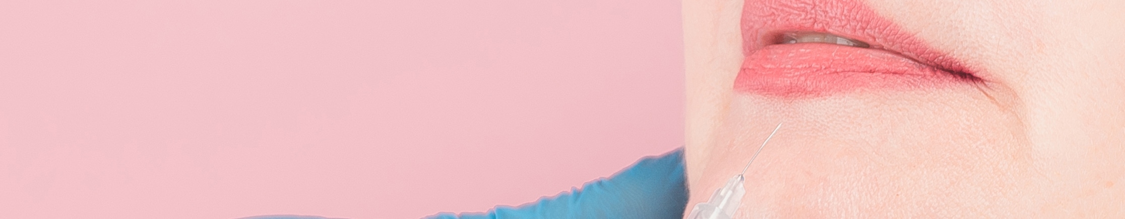 lip to chin lines treatment being performed