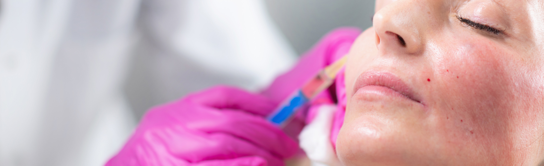 woman having cheek filler dissolving treatment