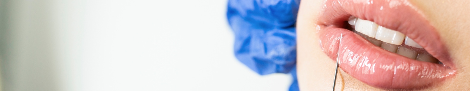 lip filler dissolving treatment