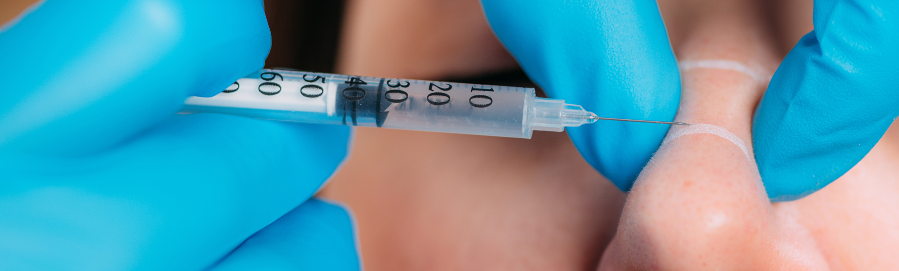 non surgical rhinoplasty being performed