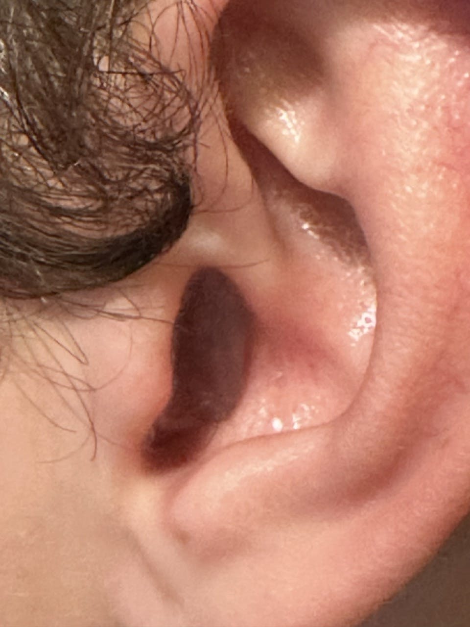 A finished ear plug in an ear