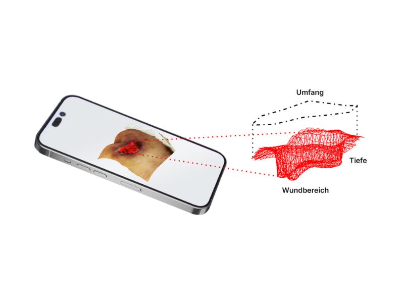 Wound treatment with the use of artificial intelligence