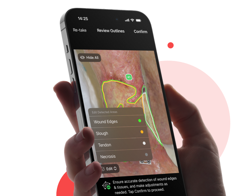 imitoWound wound docu app
