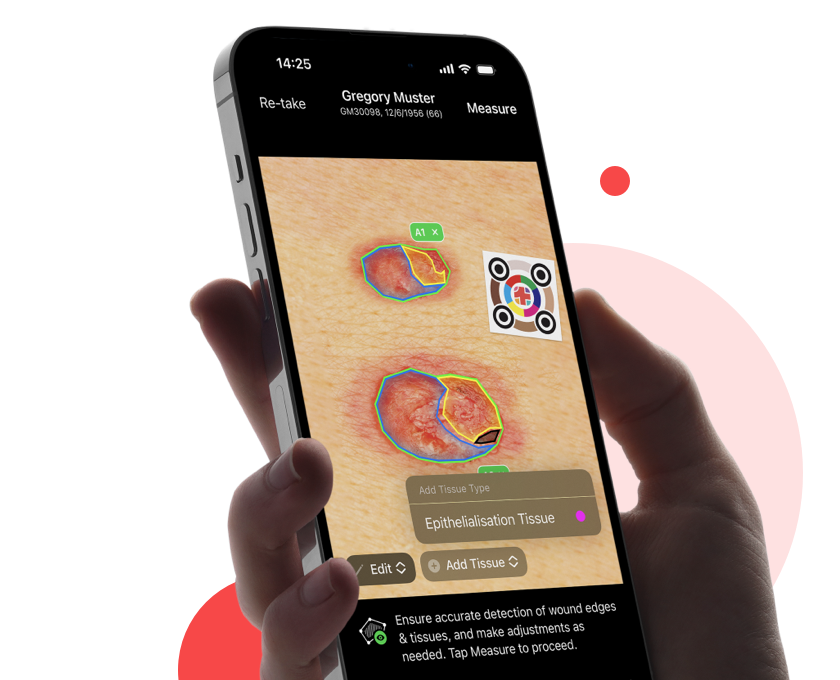 imitoWound - Gestion numérique des plaies