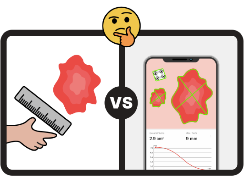 Printable wound ruler? Faster alternative to wound measurement