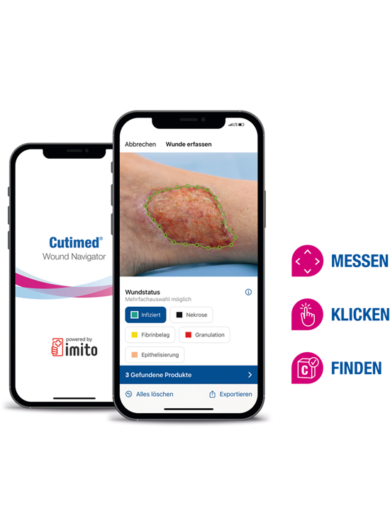 Cutimed Wound Navigator