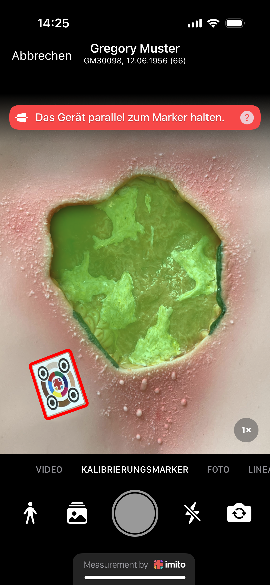 Wundlineal ciao ciao - Wundvermesssung ist heutzutage digital