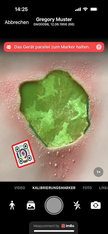 Wundlineal ciao ciao - Wundvermesssung ist heutzutage digital