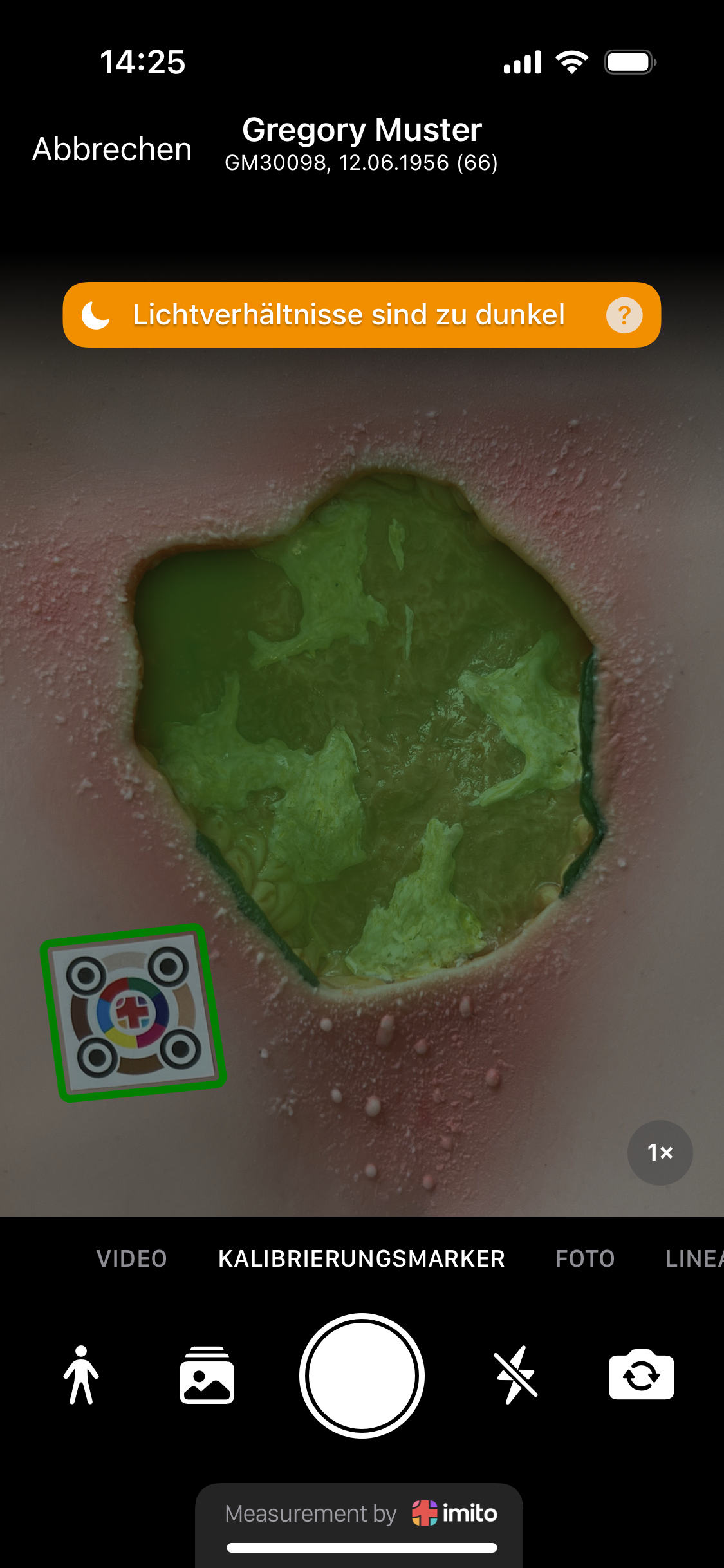 Wundlineal ciao ciao - Wundvermesssung ist heutzutage digital