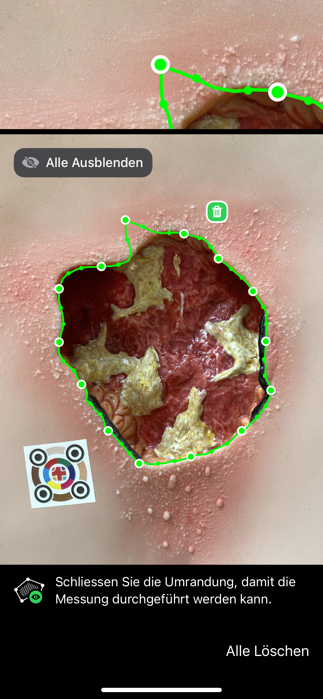 Wundlineal ciao ciao - Wundvermesssung ist heutzutage digital