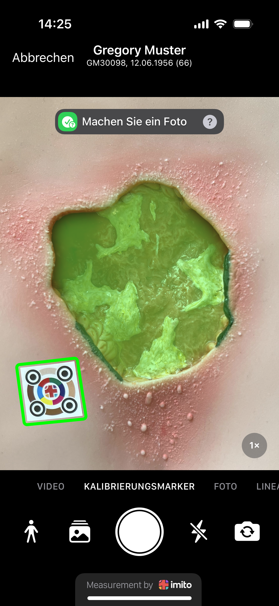 Wie man eine Wunde misst - Digital