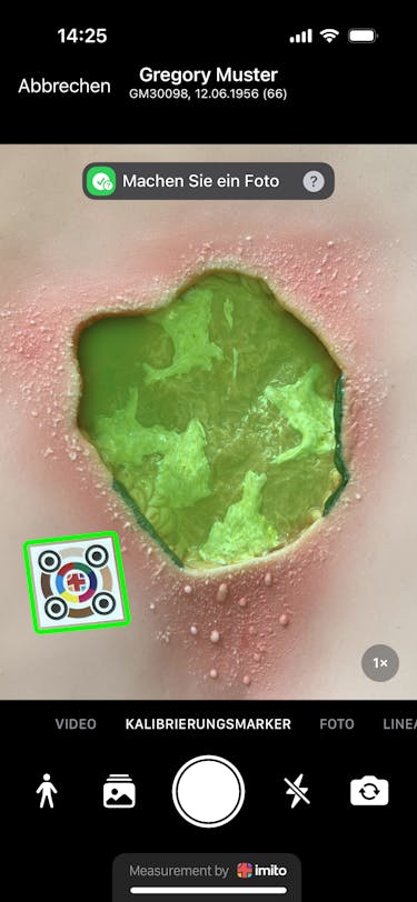 Wie man eine Wunde misst - Digital