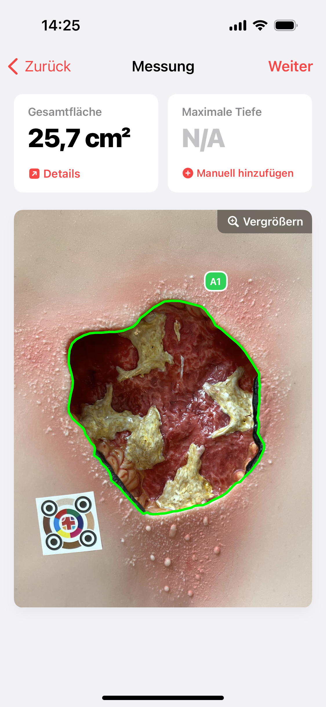 Wundfläche berechnet in Sekunden