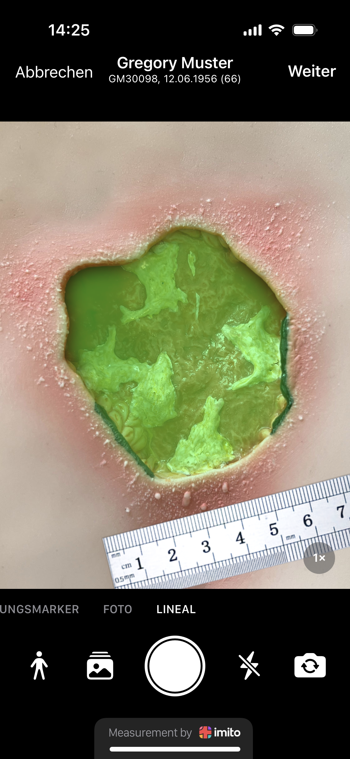 Wundlineal ciao ciao - Wundvermesssung ist heutzutage digital