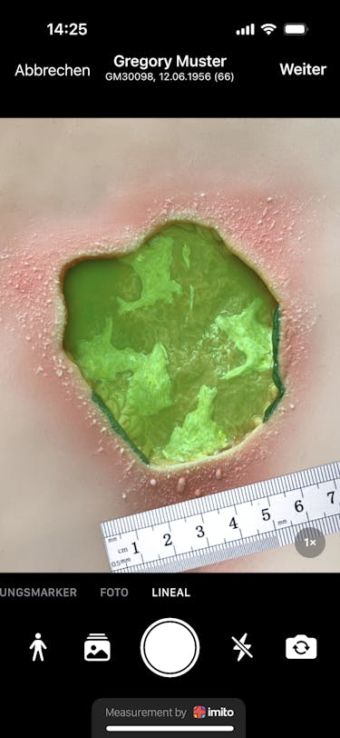 Wundlineal ciao ciao - Wundvermesssung ist heutzutage digital