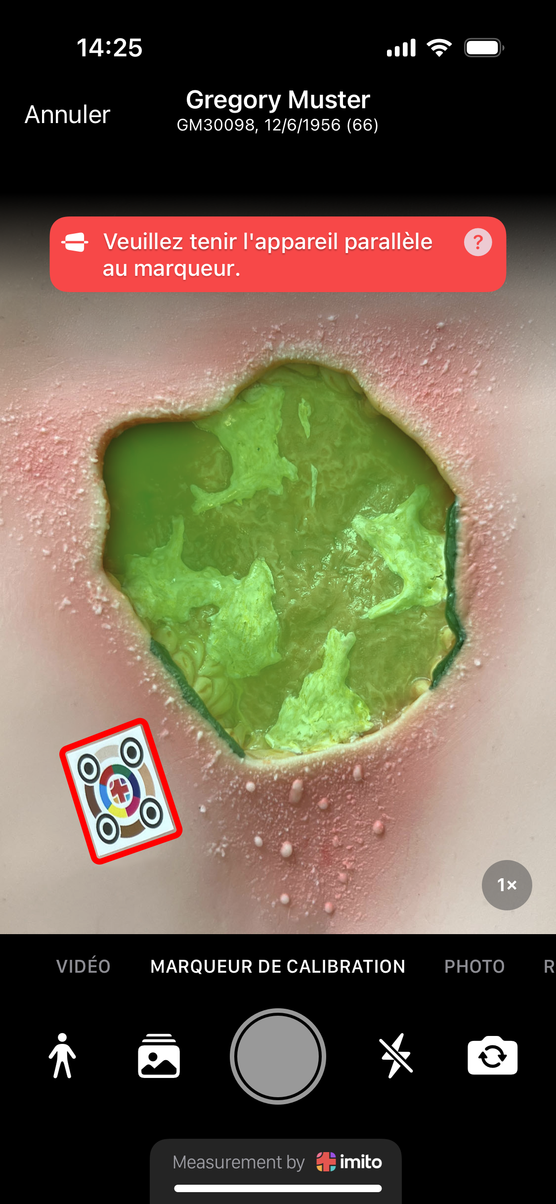 Règle à plaies ciao ciao - la mesure des plaies est aujourd'hui numérique