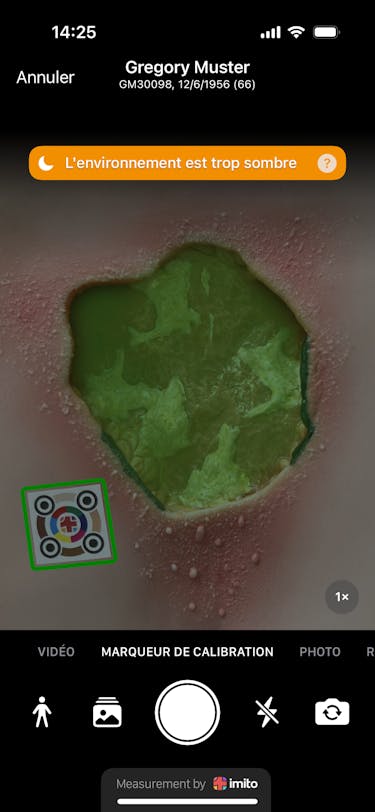 Règle à plaies ciao ciao - la mesure des plaies est aujourd'hui numérique