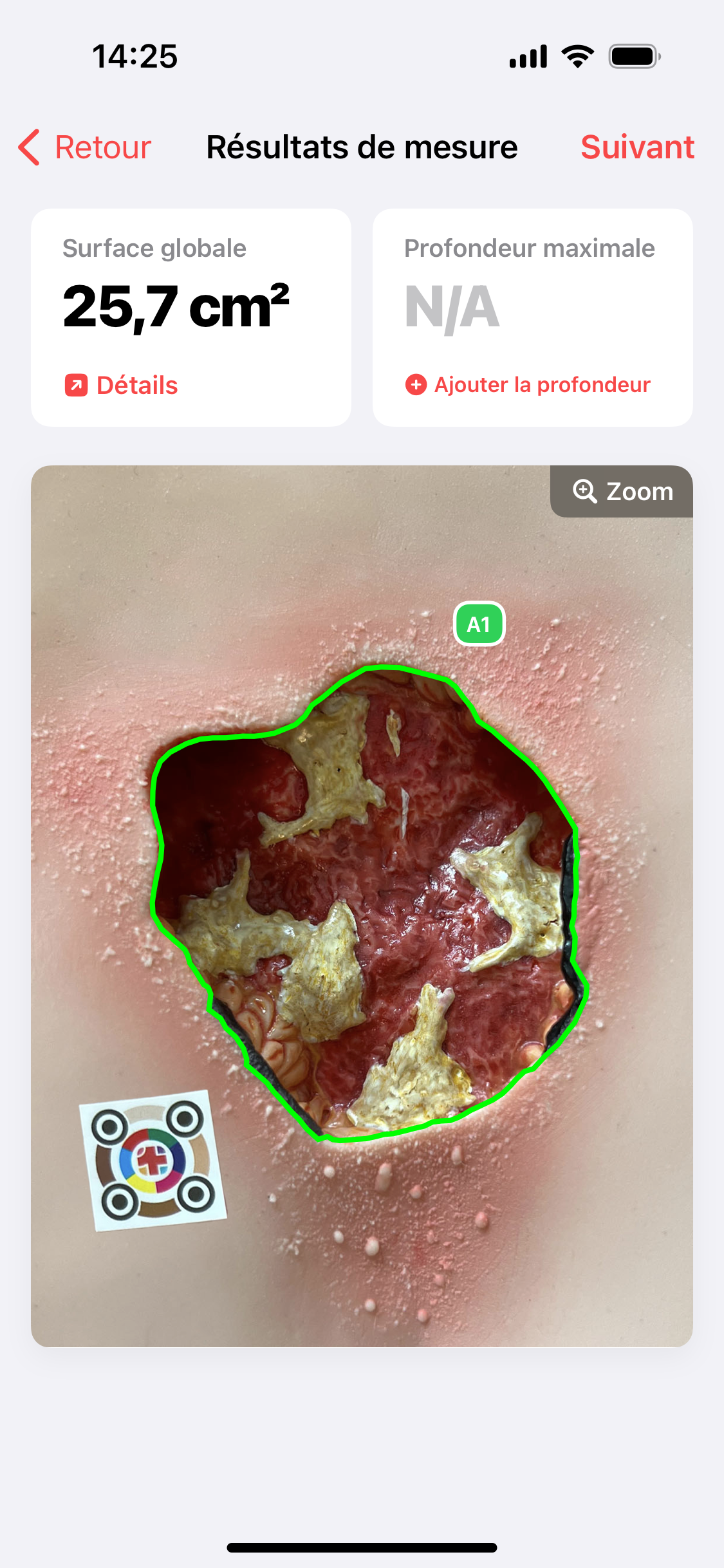 Règle à plaies ciao ciao - la mesure des plaies est aujourd'hui numérique