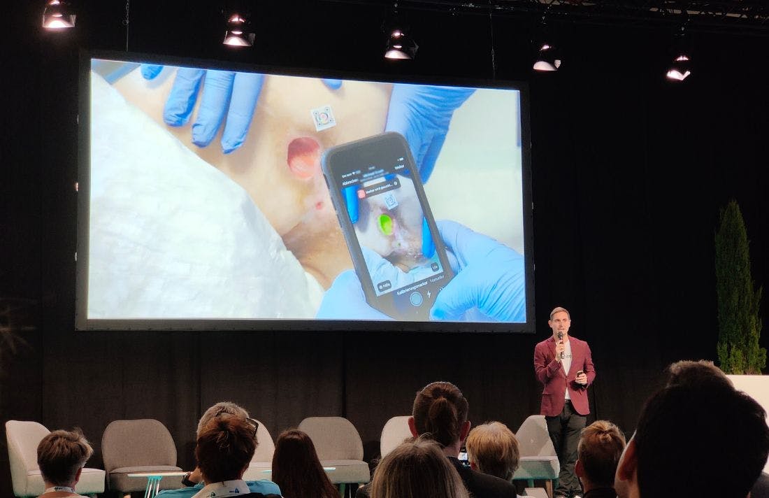 Automatic wound measurement presented by Chrysanth Sulzberger of imito