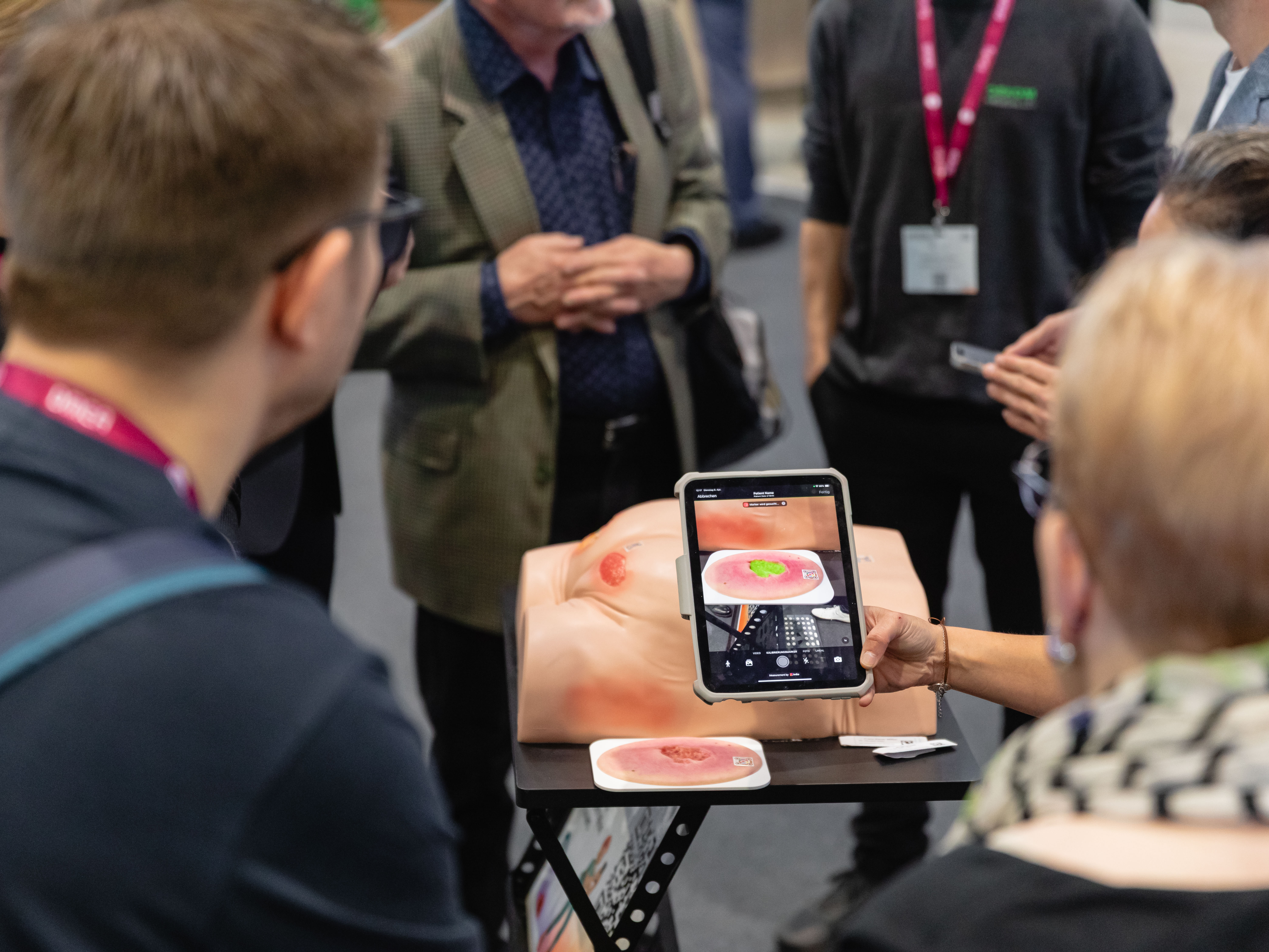 imitoWound live auf der DMEA 2025