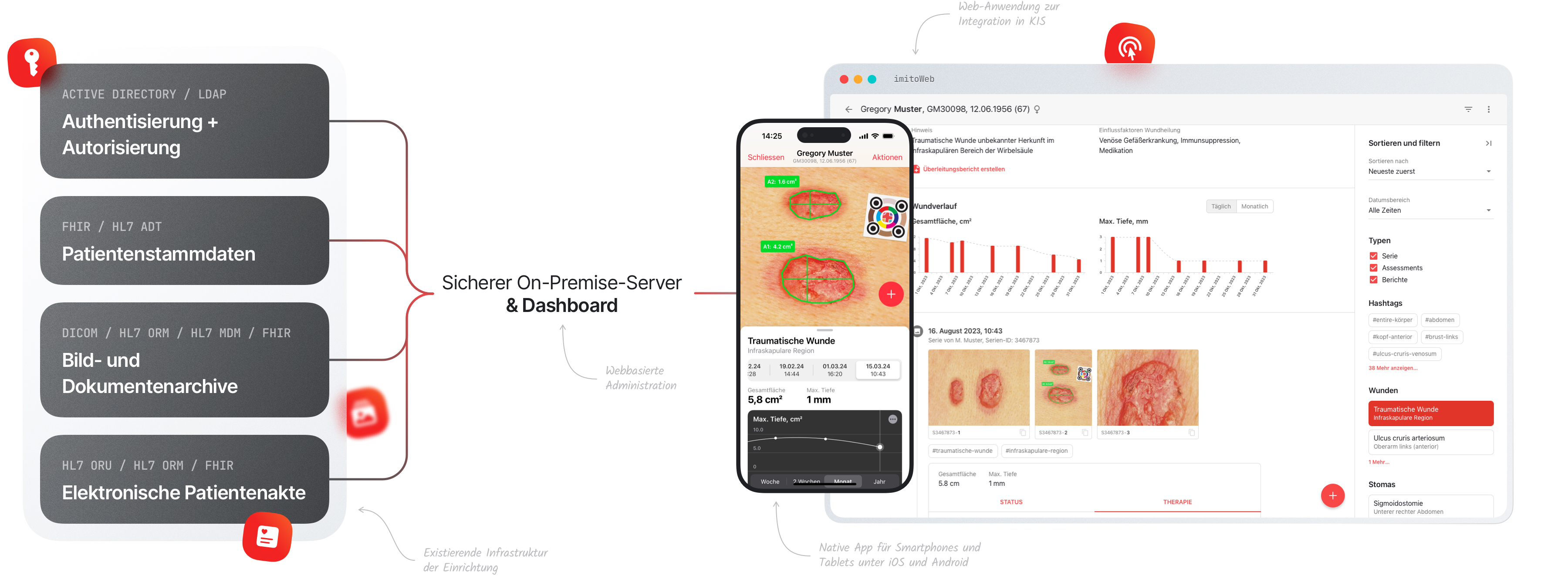 Wundvermessung und Wunddokumentation App imitoWound