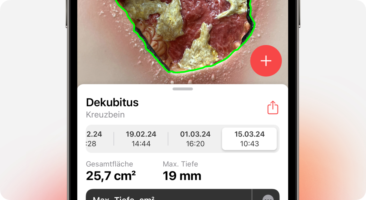 Wunddokumentation von imito mit PDF zum Ausdrucken