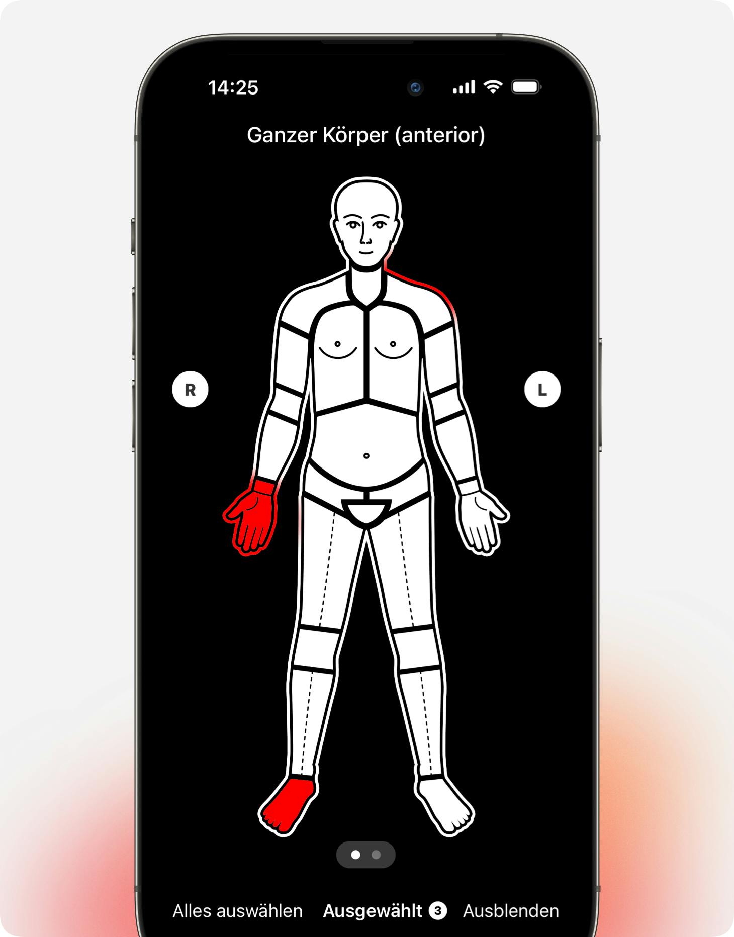 Wundlokalisation Diagramm in unserer Wunddoku App