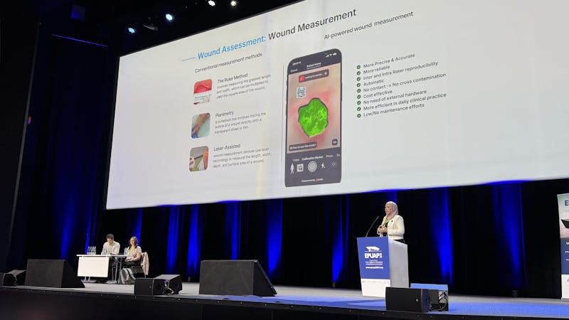 imitoWound with AI for pressure ulcer prevention and treatment