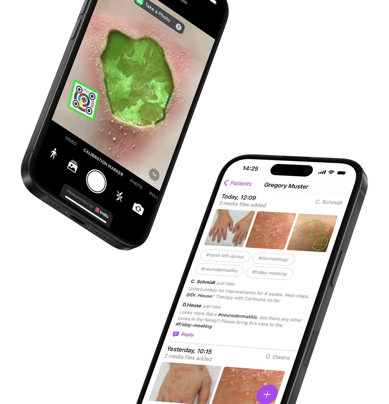 Wound care software and medical photography by imito
