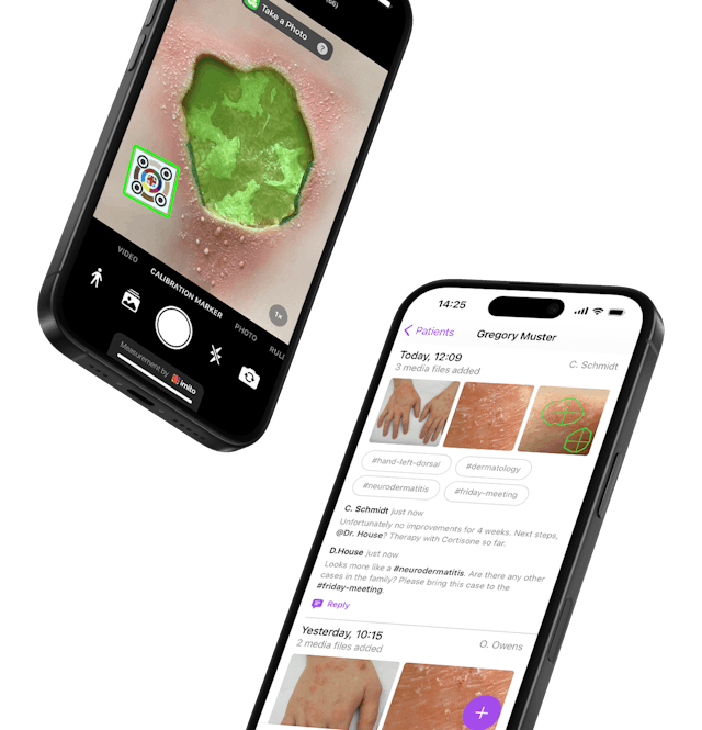 Wound care software and medical photography by imito