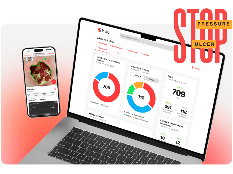 "Stop Pressure Ulcer" Day: Jeder Dekubitus ist einer zu viel.