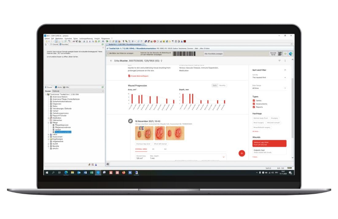 imitoWound - App für Ärzte