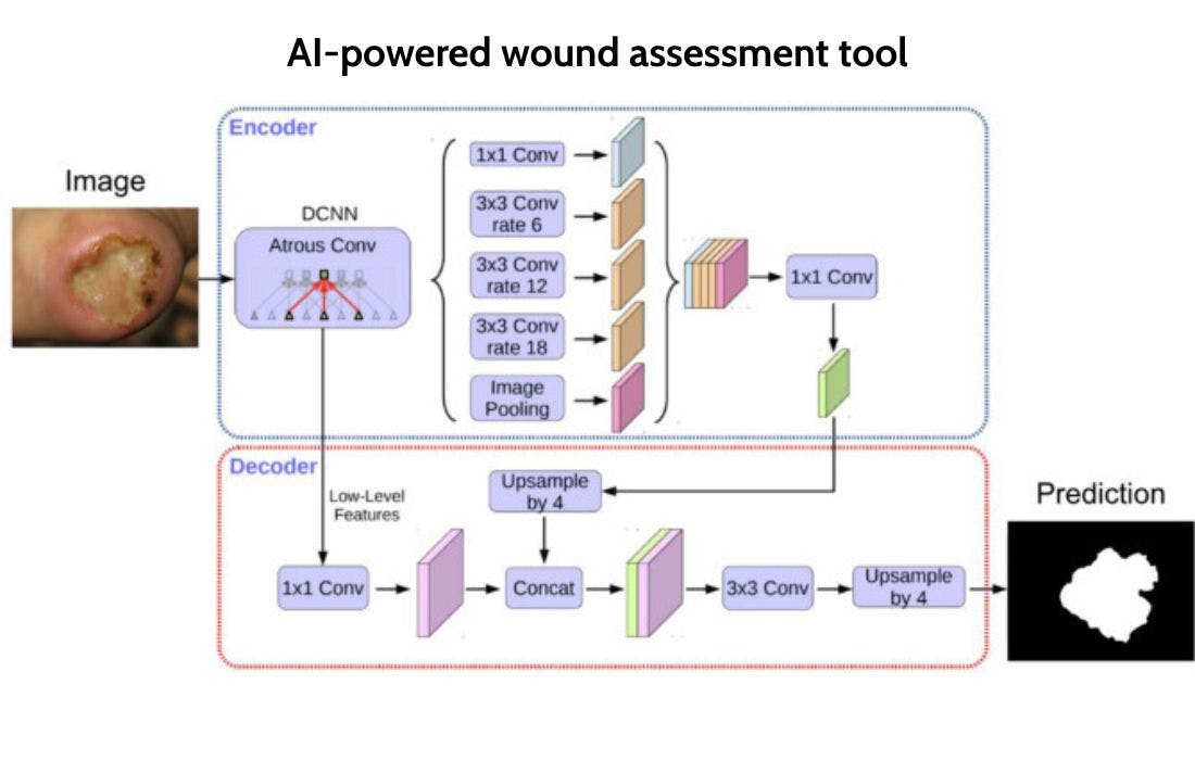 Précision de mesure des plaies grâce à l'IA