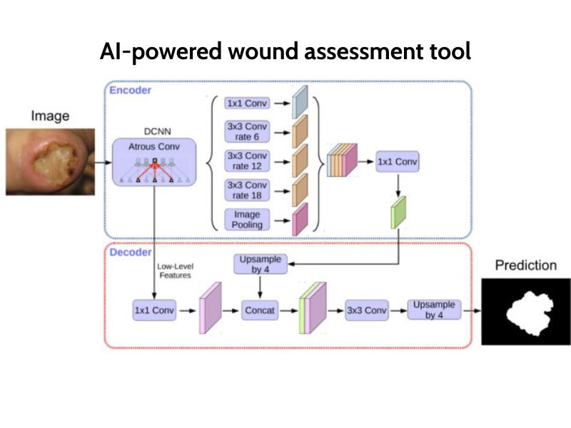 AI-powered wound segmentation tool trained on 4,000 wounds - Stefanelli et al.