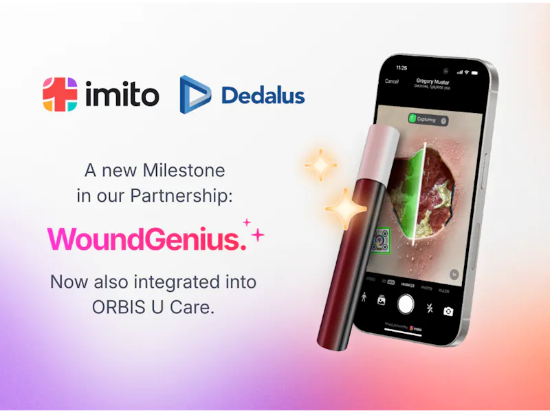 Market Launch for AI-Powered Wound Measurement in ORBIS U.