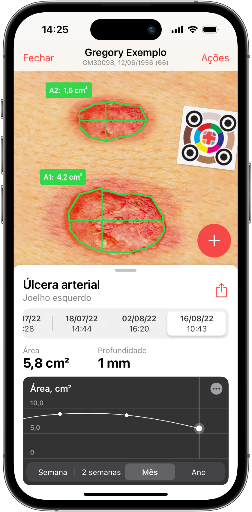 imitoWound - o app de feridas, que pensa com você